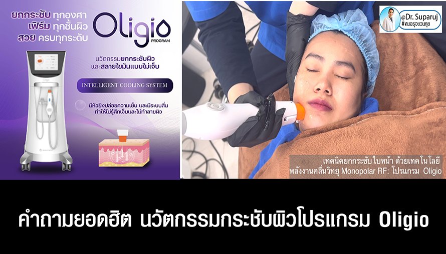 คำถามยอดฮิต นวัตกรรมกระชับผิวโปรแกรม Oligio คำถามยอดฮิต นวัตกรรมกระชับผิวโปรแกรม Oligio